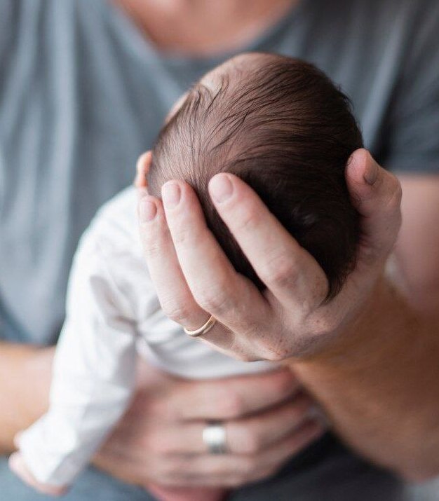 Кефалогематома