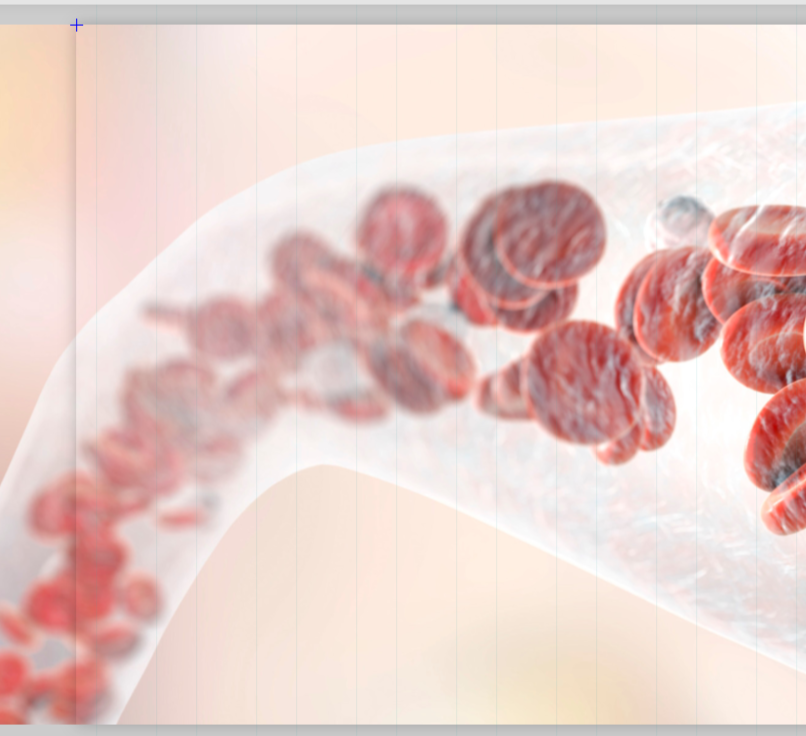 Вебинар «Железодефицитная анемия у взрослых пациентов». Дорохина Яна Олеговна